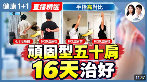 16天治好頑固型五十肩！【疼痛職人診所院長 徐子恆｜健康1+1 JoJo】